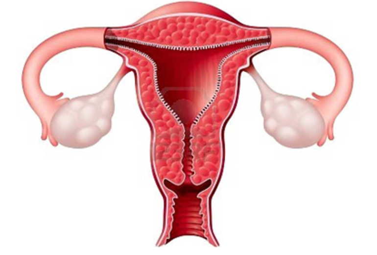 chữa bệnh phụ khoa nấm âm đạo Candida