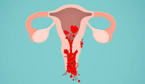 Dược liệu thảo dược cho bệnh Rong Kinh Rong HUyết