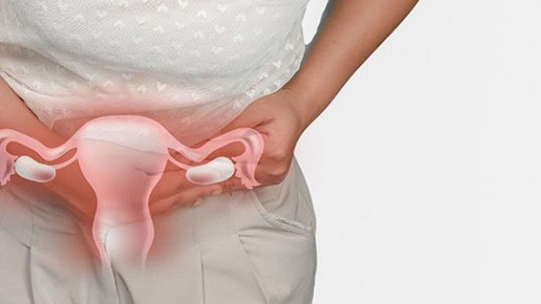 Viêm phần phụ dược liệu thảo dược