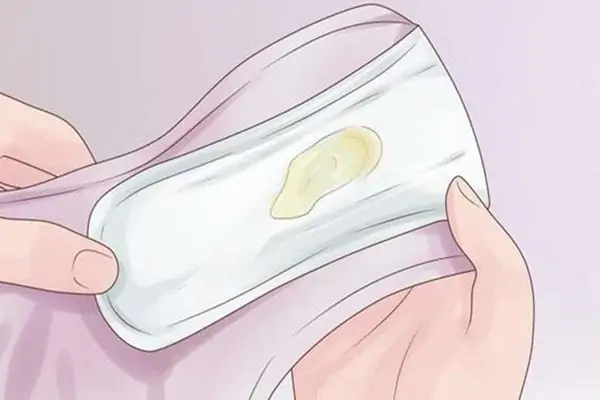 Sản dịch sau sinh